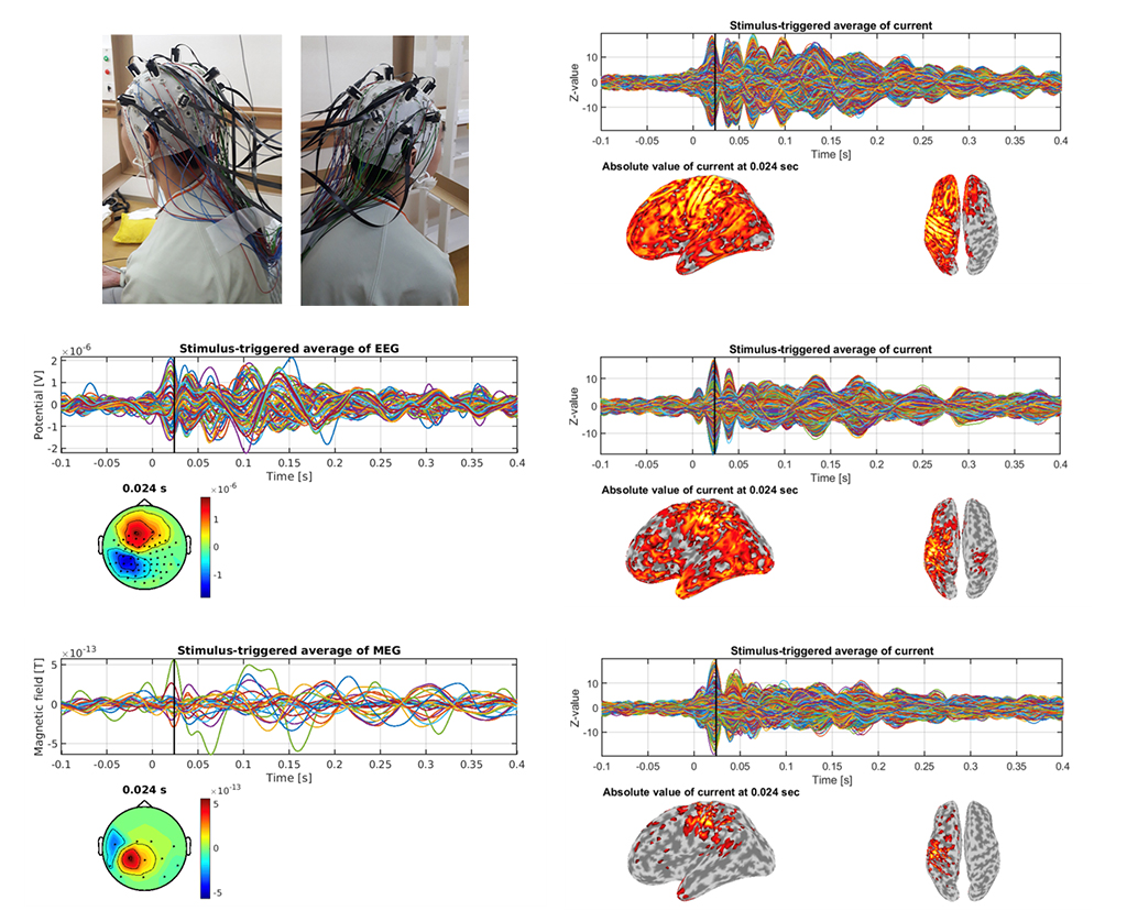 Sample results of cortical current estimations from OPM-MEG and EEG data (Task: Median Nerve Stimulation)