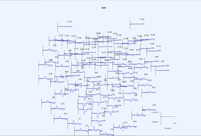 sensorarray