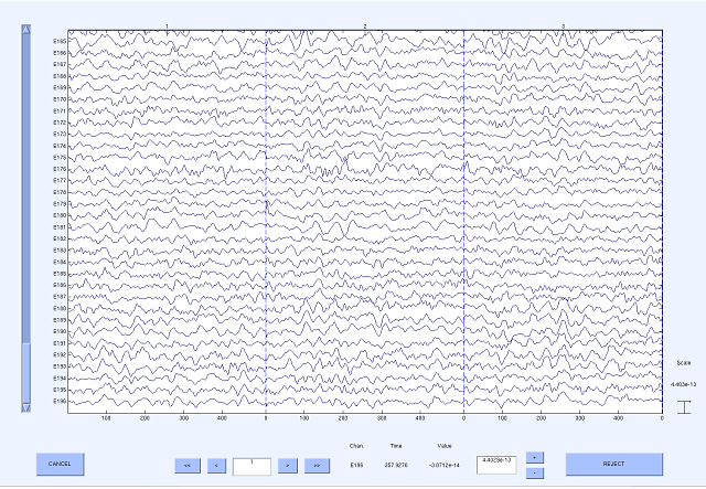 timeseries